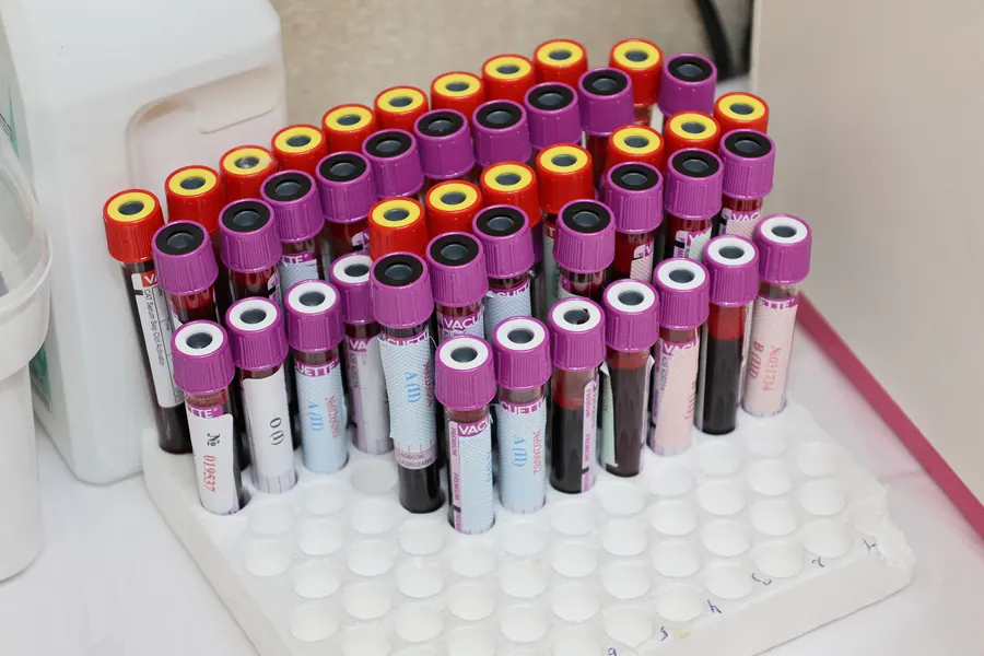 Rows of capped blood sample tubes in a laboratory rack