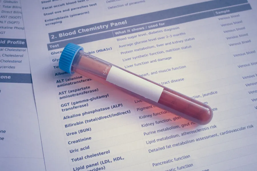 Blood sample tube resting on a printed blood chemistry panel